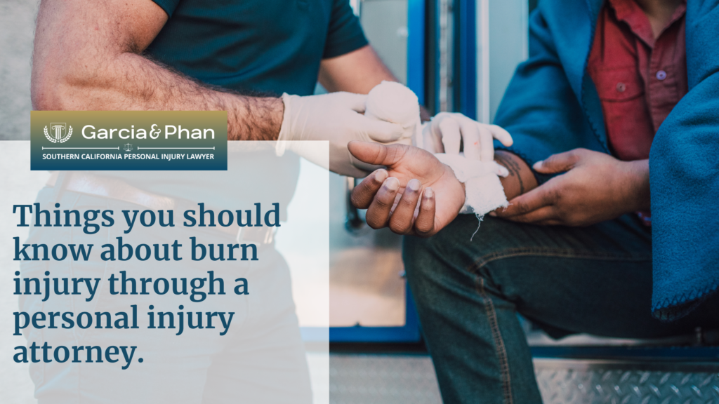 Things you should know about burn injury through a personal injury attorney. | GP